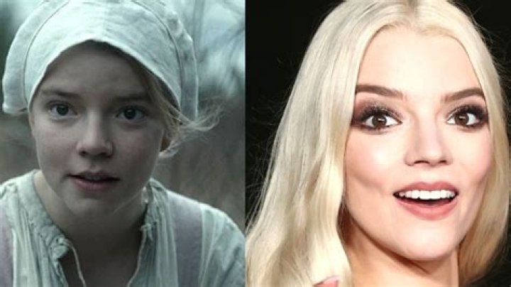 Anya Taylor-Joy’s Plastic Surgery: Did The Menu Cast Have Blepharoplasty, Brow Lift, and Buccal Fat Removal?