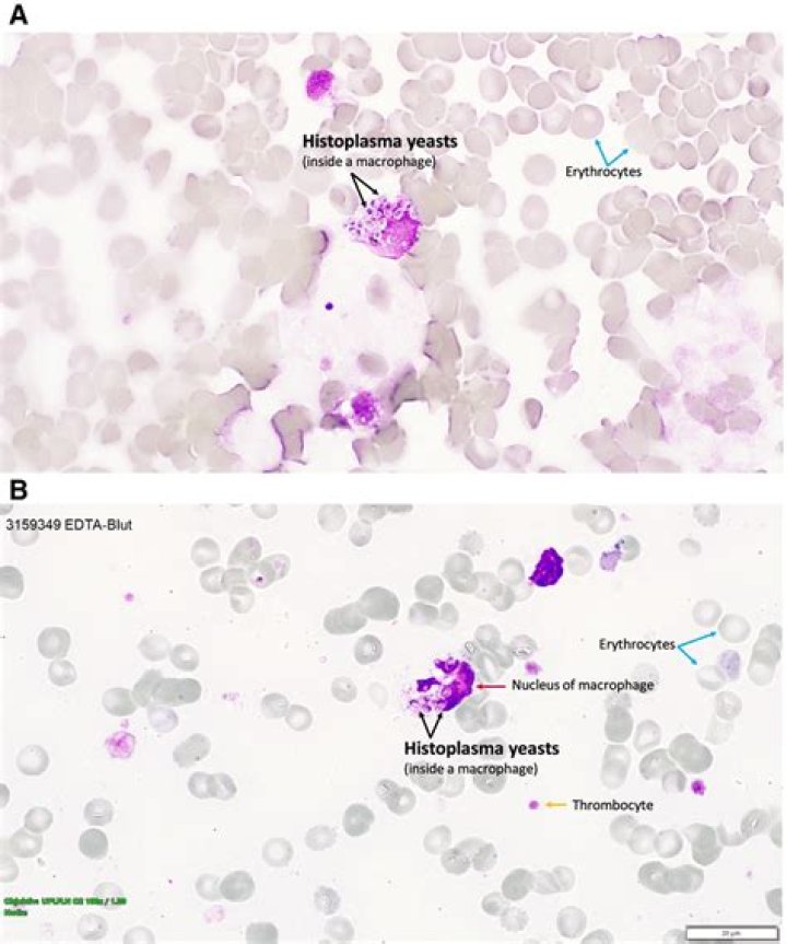 Characteristics of histoplasma capsulatum include