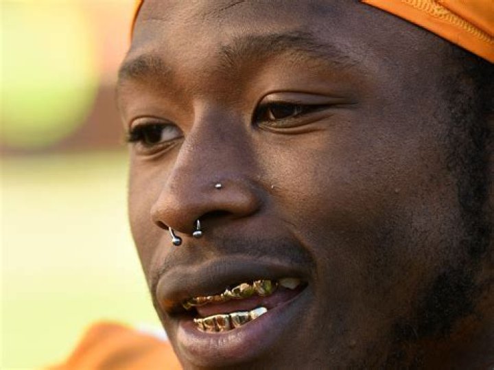Does Alvin Kamara Have Gold Teeth?