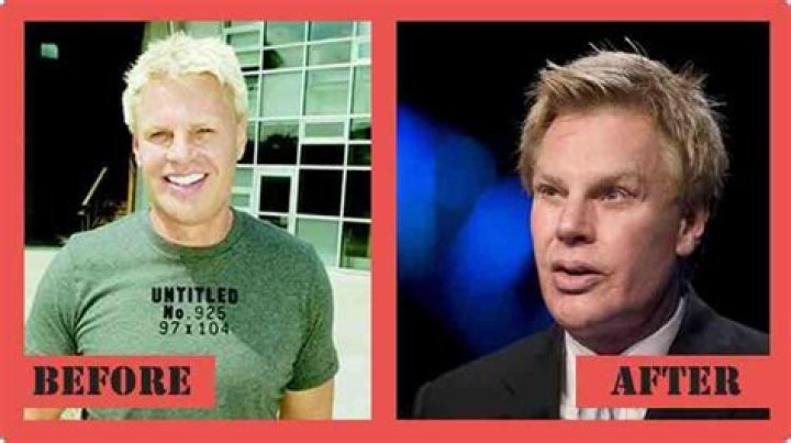 Has Mike Jeffries Had Plastic Surgery?