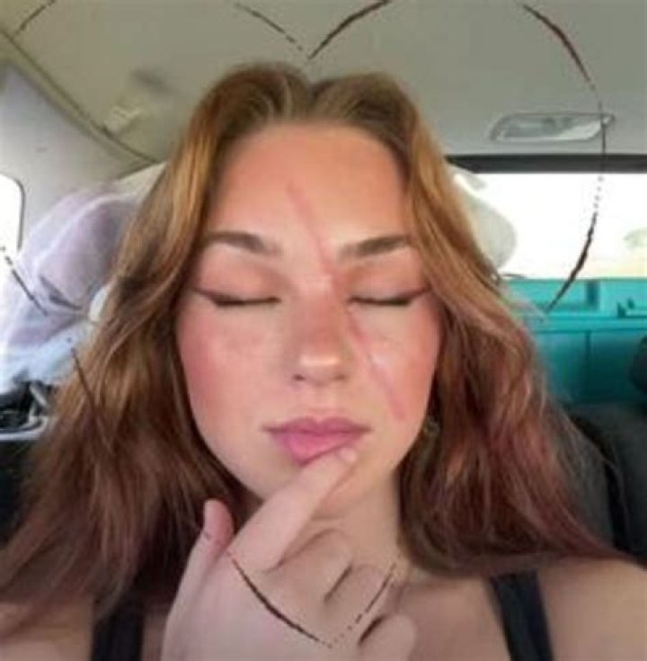 Jentri Wallace’s Scar: What Happened to Her Face? Was It an Accident?