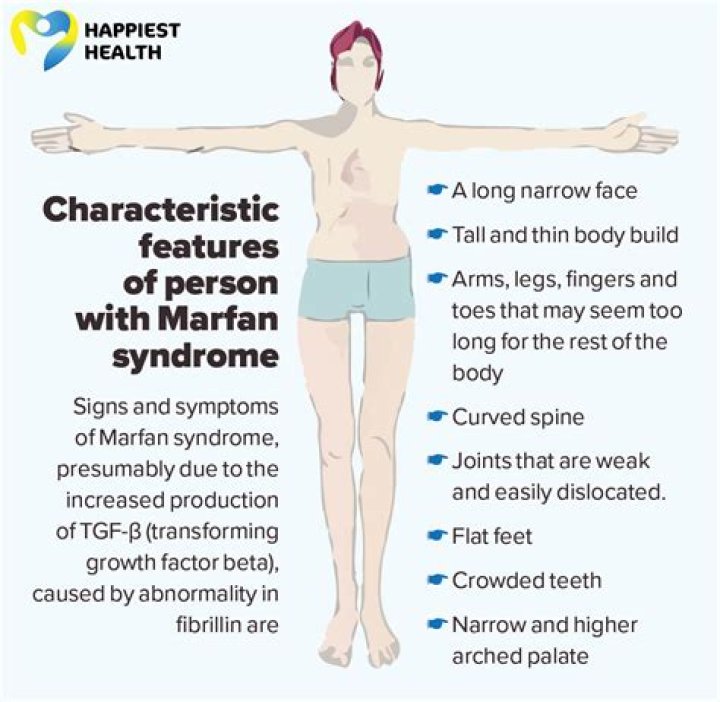 Marfan Mike Is Dead – Know About His Bio And Cause Of Death
