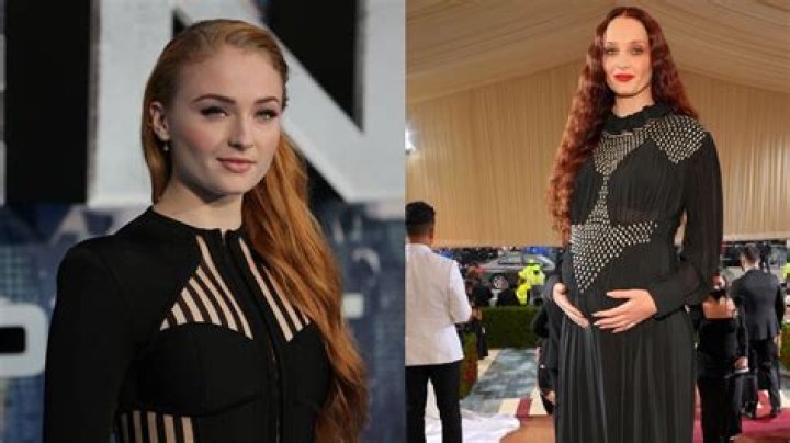 Met Gala 2022: Sophie Turner’s Plastic Surgery Rumors; Nose Job & Breast Implantation!