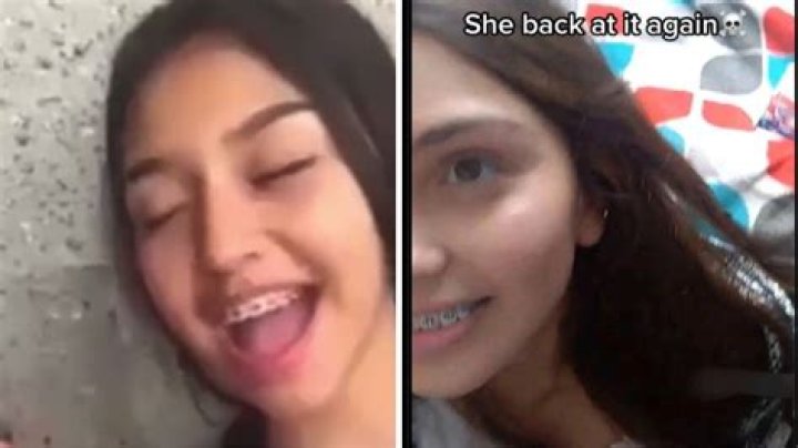 Skyleakss Braces Girl Leaked Viral Video Controversy And Scandal Explained