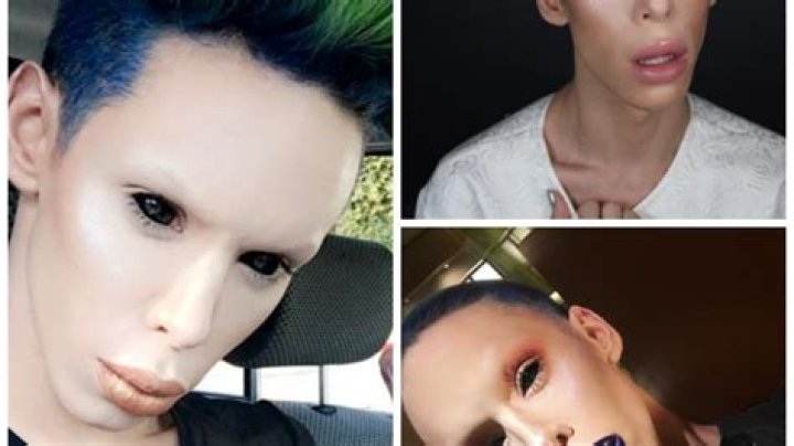 These Viral Celebrities Got Famous for Their Insane Plastic Surgery!