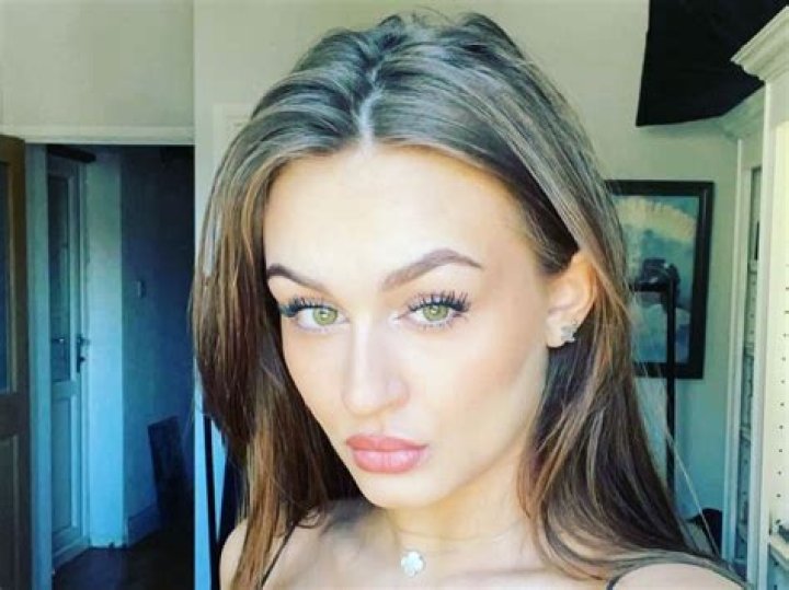 Who Is Josie Alexandra And What Happened To Her? Jay Aston Daughter Hospitalised